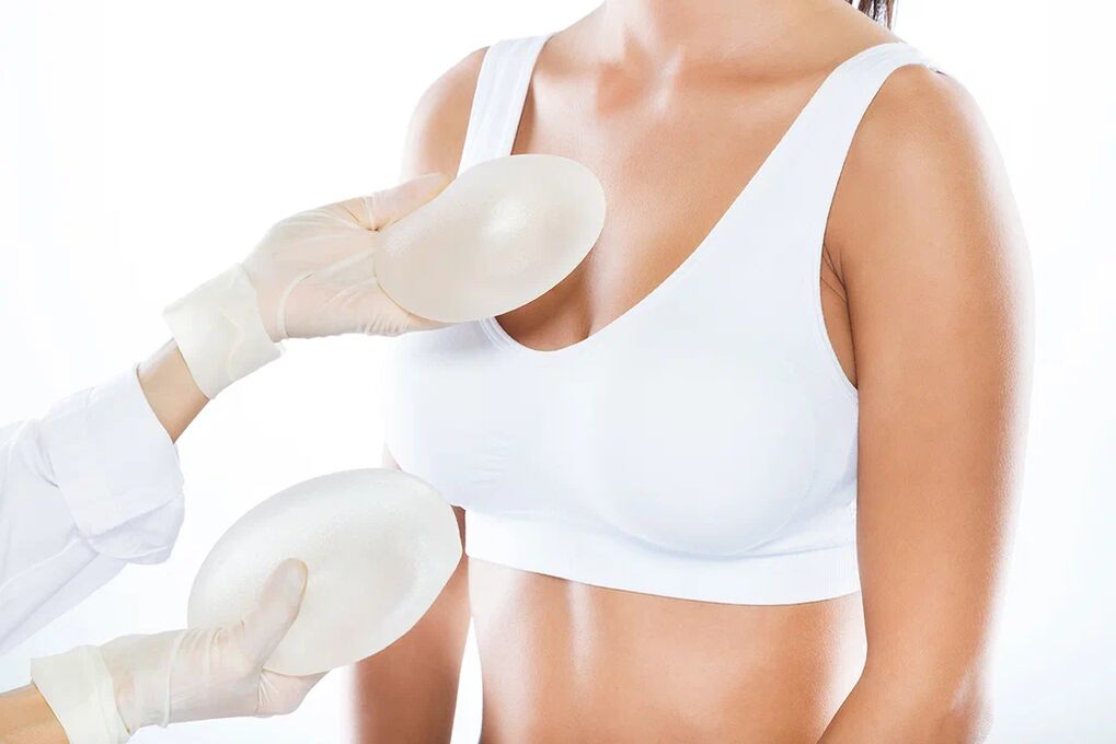 Implantatauswahl vor einer Brustvergrößerungsoperation. 