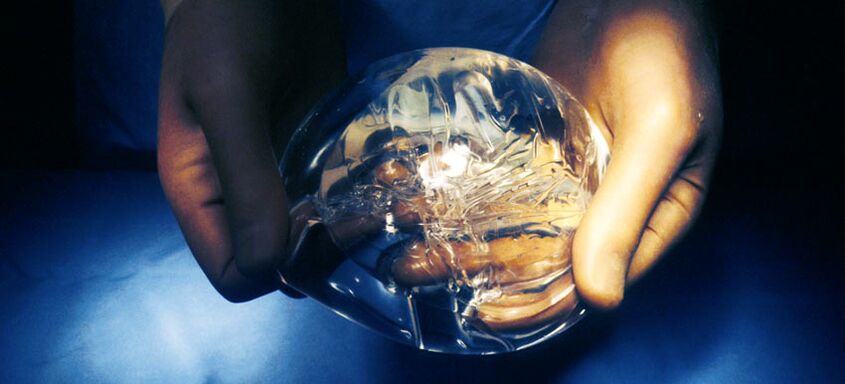 Silikon-Endoprothese